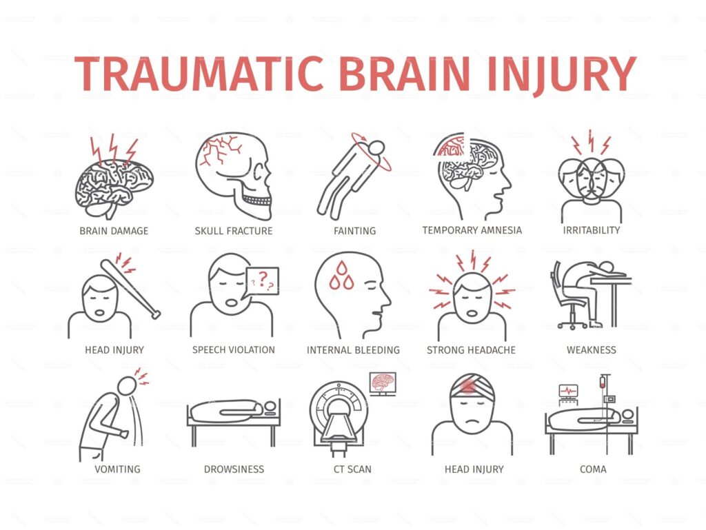 tbi-definitions